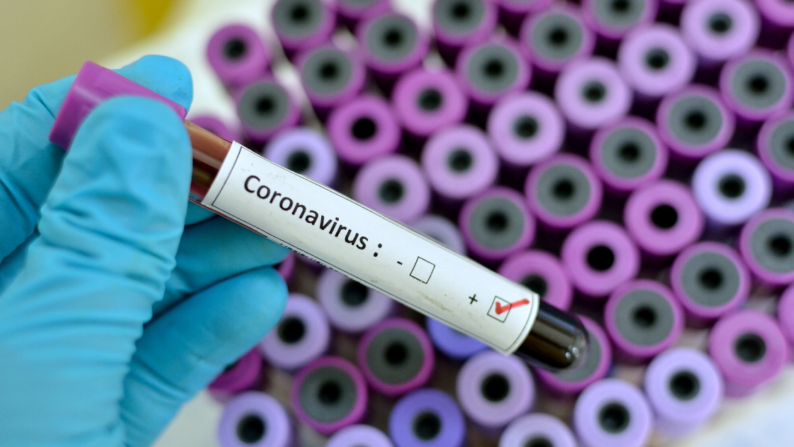 Speed is Vital in Combating Coronavirus: How Companies in the HTEC Index are Stepping Up